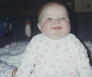 Shortly after being diagnosed with Transverse Myelitis. The medicine got the best of my cheeks...